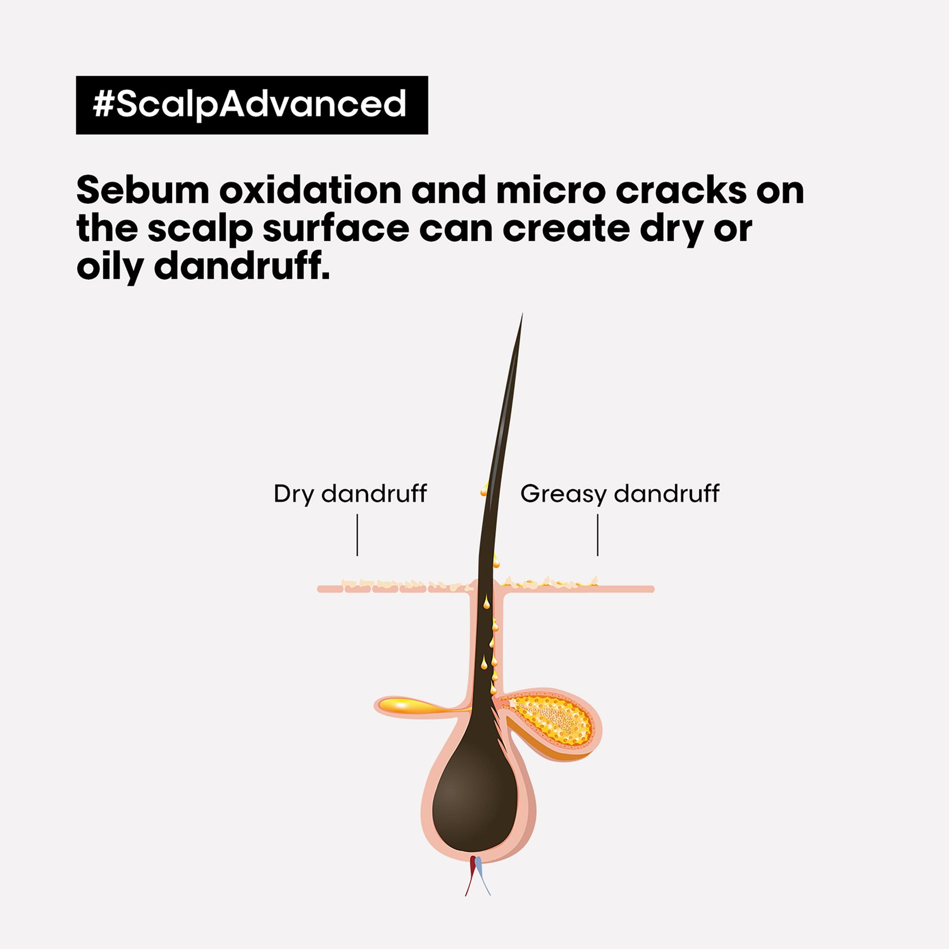 scalp-advanced-shampoo-anticaspa-dermoclarificador7